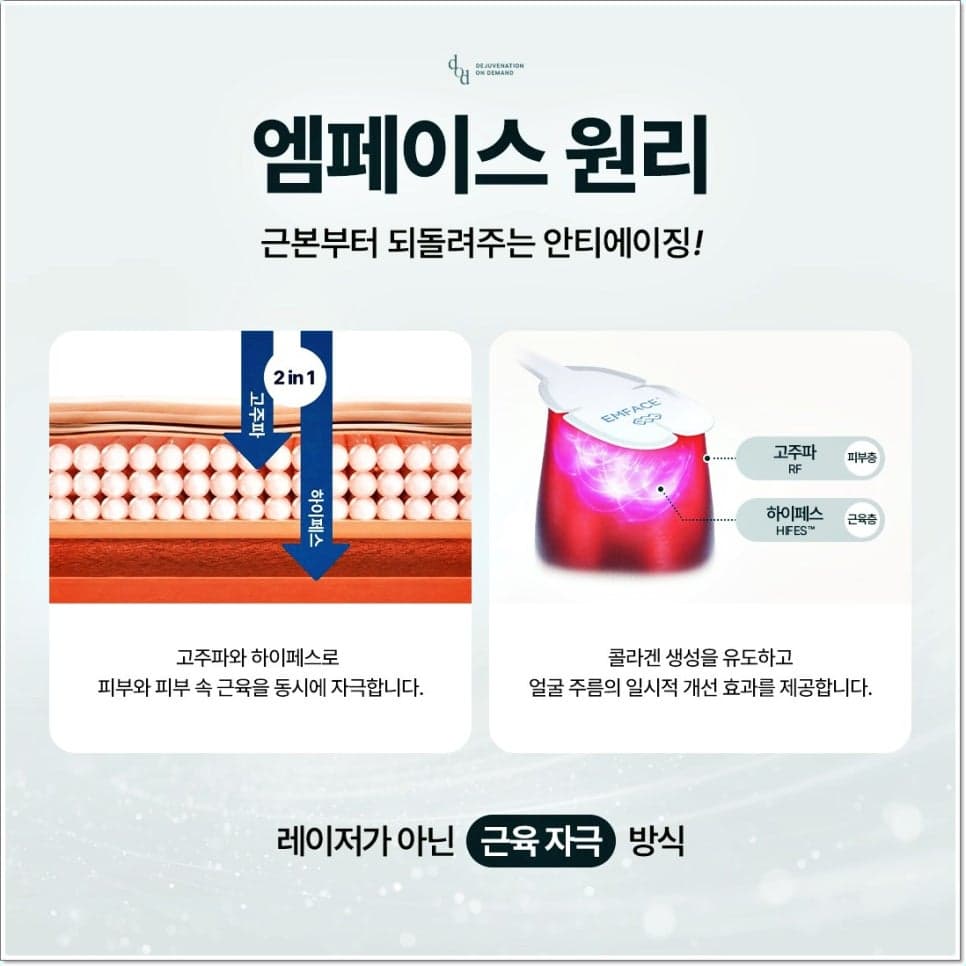 엠페이스 원리 - 고주파 RF와 HIFES로 피부와 피부 속 근육을 동시에 자극